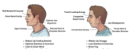 nose breathing vs mouth breathing